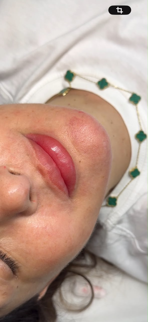 Micropigmentação Labial — Cor natural, como um batom que já é seu.